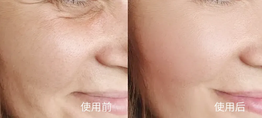 超燃现场|康容智造火爆点燃仪美尚现场,好次抛·康容造!